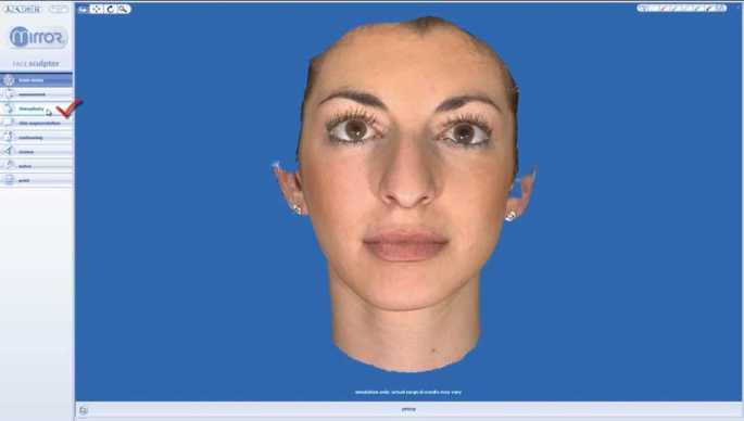 Vectra M3 3D rhinoplasty simulation system developed by Canfield Scientific. Dr.Mireas 